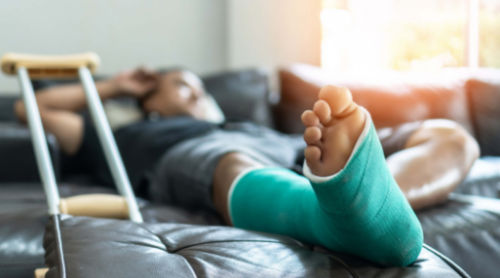 image of man with a broken leg